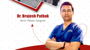 Hair Transplant service Provider in lucknow 